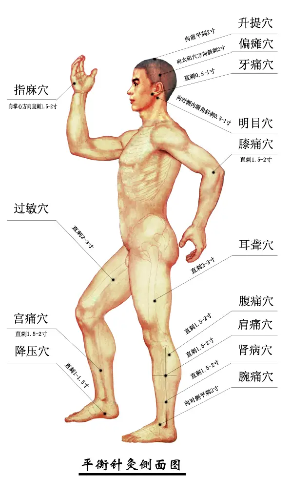 平衡针灸穴位侧