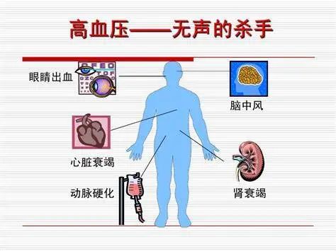高血压是什么有几种 高血压是什么有几种