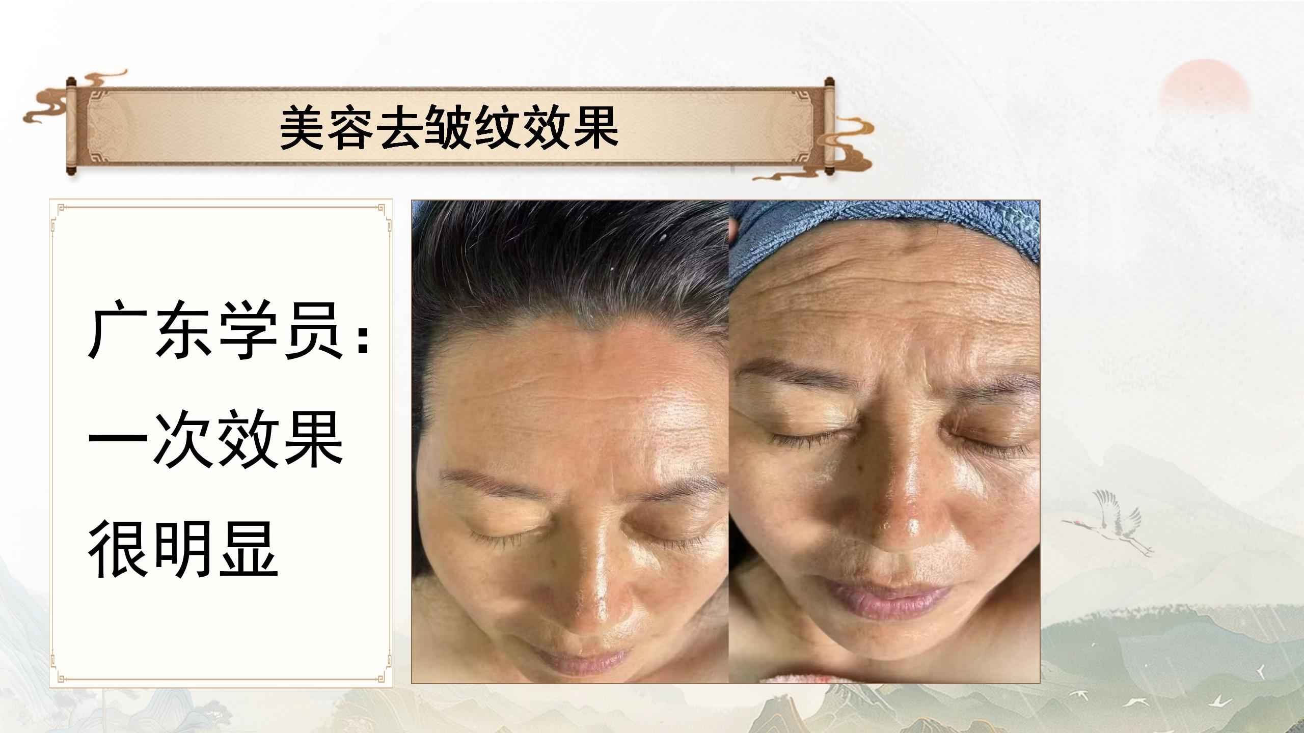 250418msjzyhz42.jpg 250418msjzyhz42.jpg